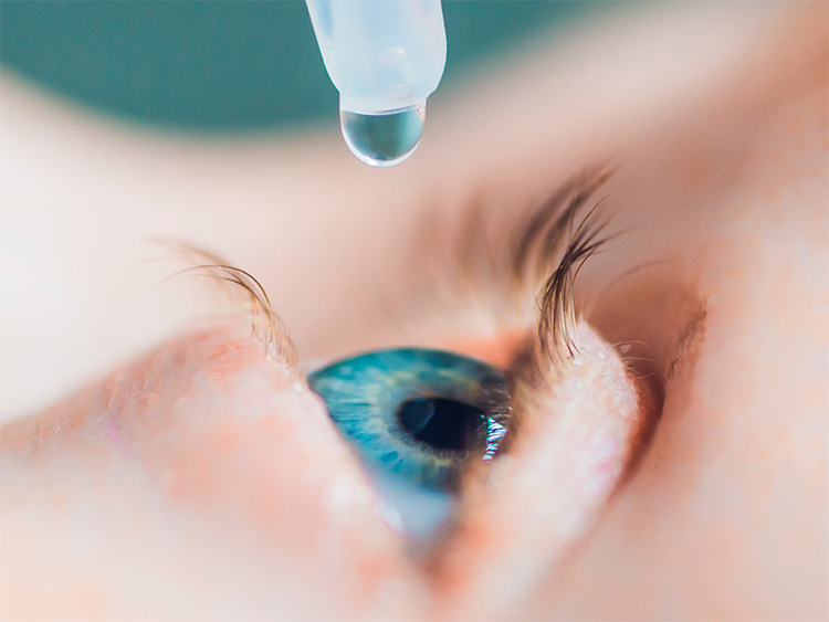 Aplicación de gotas oftálmicas para tratamiento ocular